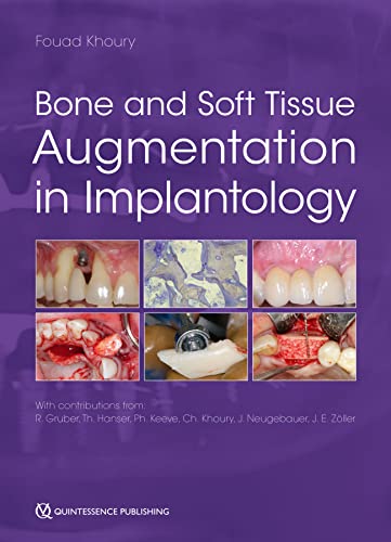 Bone and Soft Tissue Augmentation in Implantology - Epub + Converted Pdf